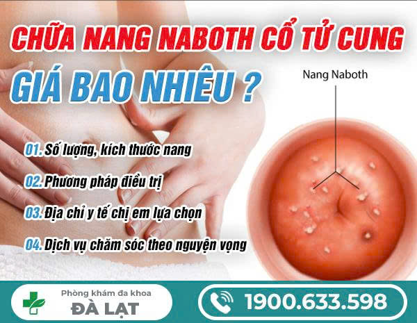 Hình ảnh minh họa